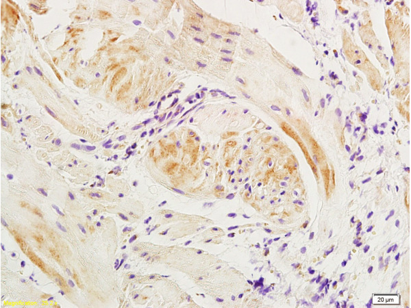 Formalin-fixed and paraffin embedded: dog bladder tissue labeled with Anti-Actin A/Alpha SMA Polyclonal Antibody, Unconjugated (bs-0189R) at 1:300, followed by conjugation to the secondary antibody.