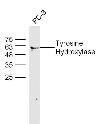 Human PC-3 lysates probed with Tyrosine Hydroxylase Polyclonal Antibody, unconjugated (bs-0016R) at 1:300 overnight at 4°C followed by a conjugated secondary antibody at 1:10000 for 60 minutes at 37°C.