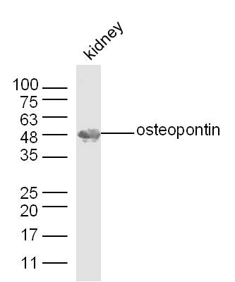 Mouse kidney lysates probed with Osteopontin Polyclonal Antibody, unconjugated (bs-0019R) at 1:300 overnight at 4\u00b0C followed by a conjugated secondary antibody at 1:10000 for 60 minutes at 37\u00b0C.