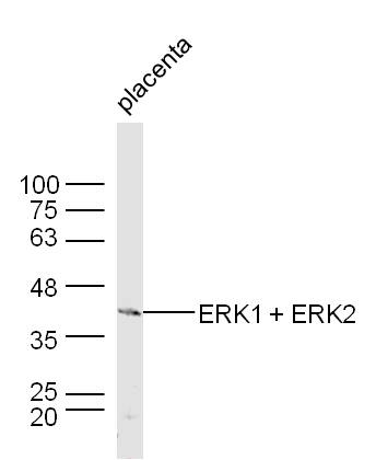 Mouse placenta lysates probed with ERK1 + ERK2 Polyclonal Antibody, unconjugated (bs-0022R) at 1:300 overnight at 4°C followed by a conjugated secondary antibody at 1:10000 for 60 minutes at 37°C.