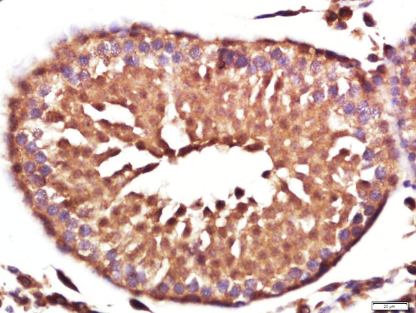 Paraformaldehyde-fixed, paraffin embedded rat testis; Antigen retrieval by boiling in sodium citrate buffer (pH6.0) for 15min; Block endogenous peroxidase by 3% hydrogen peroxide for 20 minutes; Blocking buffer (normal goat serum) at 37°C for 30min; Antibody incubation with Vinculin Polyclonal Antibody, Unconjugated (bs-6640R) at 1:400 overnight at 4°C, followed by a conjugated secondary for 20 minutes and DAB staining.
