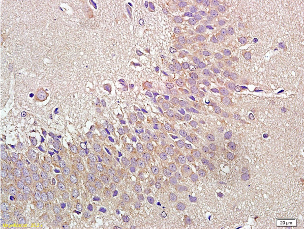 Formalin-fixed and paraffin embedded rat brain labeled with Anti-NPY1R Polyclonal Antibody, Unconjugated (bs-1070R) at 1:400 followed by conjugation to the secondary antibody and DAB staining.
