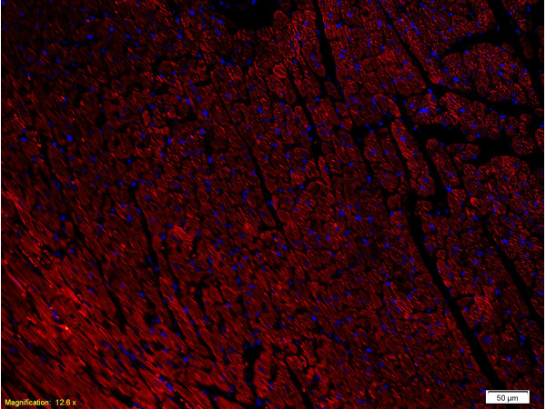 Formalin-fixed and paraffin-embedded rat heart labeled with Anti-NPY1R Polyclonal Antibody, Unconjugated(bs-1070R) 1:400, overnight at 4°C, The secondary antibody was Goat Anti-Rabbit IgG, PE conjugated(bs-0295G-PE)used at 1:200 dilution for 40 minutes at 37°C.