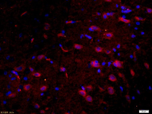 Paraformaldehyde-fixed, paraffin embedded rat brain; Antigen retrieval by boiling in sodium citrate buffer (pH6) for 15min; Block endogenous peroxidase by 3% hydrogen peroxide for 30 minutes; Blocking buffer (normal goat serum) at 37°C for 20min; Antibody incubation with \tTau protein Polyclonal Antibody, Unconjugated (bs-0157R) at 1:200 overnight at 4°C, followed by a conjugated secondary Goat Anti-Rabbit IgG, Cy3 conjugated(bs-0295G-Cy3)used at 1:200 dilution for 40 minutes at 37°C. DAPI(5ug/ml) was used to stain the cell nuclei.