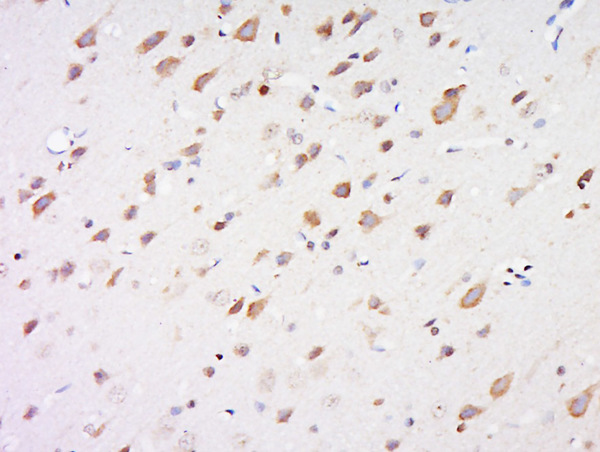 Paraformaldehyde-fixed, paraffin embedded rat brain tissue; Antigen retrieval by boiling in sodium citrate buffer(pH6) for 15min; Block endogenous peroxidase by 3% hydrogen peroxide for 30 minutes; Blocking buffer (normal goat serum) at 37°C for 20min; Antibody incubation with Rabbit Anti-LPL protein Polyclonal Antibody, Unconjugated (bs-2336R) at 1:500 overnight at 4°C, followed by a conjugated secondary and DAB staining Paraformaldehyde-fixed, paraffin embedded rat brain tissue; Antigen retrieval by boiling in sodium citrate buffer(pH6) for 15min; Block endogenous peroxidase by 3% hydrogen peroxide for 30 minutes; Blocking buffer (normal goat serum) at 37°C for 20min; Antibody incubation with Rabbit Anti-LPL protein Polyclonal Antibody, Unconjugated (bs-2336R) at 1:500 overnight at 4°C, followed by a conjugated secondary and DAB staining