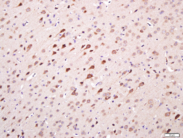 Paraformaldehyde-fixed, paraffin embedded rat brain tissue; Antigen retrieval by boiling in sodium citrate buffer(pH6) for 15min; Block endogenous peroxidase by 3% hydrogen peroxide for 20 minutes; Blocking buffer (normal goat serum) at 37°C for 30min; Antibody incubation with TMEM158 Polyclonal Antibody, Unconjugated (bs-11770R) at 1:400 overnight at 4°C, followed by a conjugated secondary and DAB staining