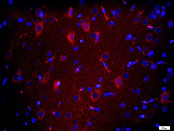 Paraformaldehyde-fixed, paraffin embedded rat brain tissue; Antigen retrieval by boiling in sodium citrate buffer(pH6) for 15min; Block endogenous peroxidase by 3% hydrogen peroxide for 20 minutes; Blocking buffer (normal goat serum) at 37°C for 30min; Antibody incubation with TMEM158 Polyclonal Antibody, Unconjugated (bs-11770R) at 1:200 overnight at 4°C, followed by a conjugated secondary and DAPI staining