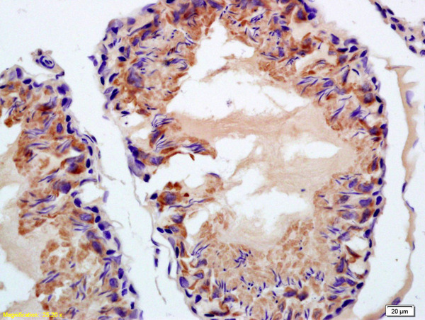 Formalin-fixed and paraffin embedded rat testis labeled with Rabbit Anti Phospho-BAP1(Ser592)Polyclonal Antibody, Unconjugated (bs-3051R) at 1:200 followed by conjugation to the secondary antibody and DAB staining