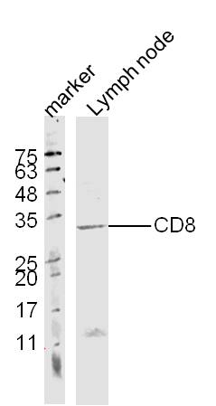 Mouse lymph node lysates probed with CD8 Polyclonal Antibody, unconjugated (bs-0648R) at 1:300 overnight at 4°C followed by a conjugated secondary antibody at 1:10000 for 60 minutes at 37°C.