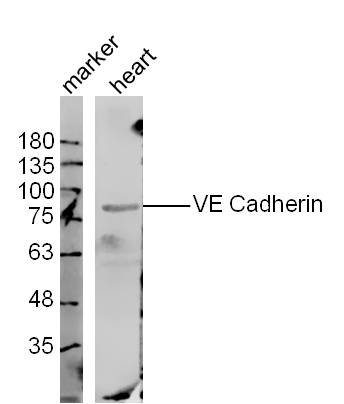 Mouse heart lysates probed with VE Cadherin Polyclonal Antibody, unconjugated (bs-0878R) at 1:300 overnight at 4\u00b0C followed by a conjugated secondary antibody at 1:10000 for 60 minutes at 37\u00b0C.