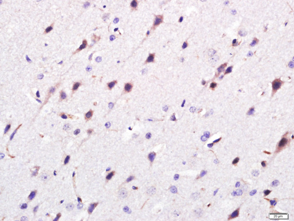 Paraformaldehyde-fixed, paraffin embedded rat brain; Antigen retrieval by boiling in sodium citrate buffer (pH6.0) for 15min; Block endogenous peroxidase by 3% hydrogen peroxide for 20 minutes; Blocking buffer (normal goat serum) at 37°C for 30min; Antibody incubation with Giantin/GOLGB1 Polyclonal Antibody Polyclonal Antibody, Unconjugated (bs-13356R) at 1:400 overnight at 4°C, followed by a conjugated secondary (sp-0023) for 20 minutes and DAB staining.