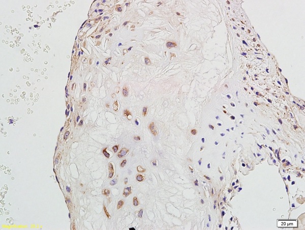 Formalin-fixed and paraffin embedded rat heart labeled with Anti-GADD45 Polyclonal Antibody, Unconjugated (bs-1360R)  followed by conjugation to the secondary antibody and DAB staining