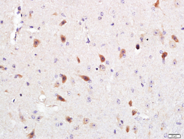 Paraformaldehyde-fixed, paraffin embedded mouse brain; Antigen retrieval by boiling in sodium citrate buffer (pH6.0) for 15min; Block endogenous peroxidase by 3% hydrogen peroxide for 20 minutes; Blocking buffer (normal goat serum) at 37°C for 30min; Antibody incubation with Optineurin Polyclonal Antibody, Unconjugated (bs-13658R) at 1:400 overnight at 4°C, followed by a conjugated secondary for 20 minutes and DAB staining.