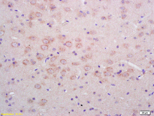 Formalin-fixed and paraffin embedded rat brain labeled with  Rabbit Anti Phospho-NMDAR1(Ser890)Polyclonal Antibody, Unconjugated (bs-3301R) at 1:200 followed by conjugation to the secondary antibody and DAB staining