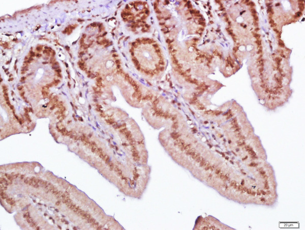 Paraformaldehyde-fixed, paraffin embedded mouse small intestine; Antigen retrieval by boiling in sodium citrate buffer (pH6.0) for 15min; Block endogenous peroxidase by 3% hydrogen peroxide for 20 minutes; Blocking buffer (normal goat serum) at 37°C for 30min; Antibody incubation with SLC38A2 Polyclonal Antibody, Unconjugated (bs-12125R) at 1:400 overnight at 4°C, followed by a conjugated secondary for 20 minutes and DAB staining.