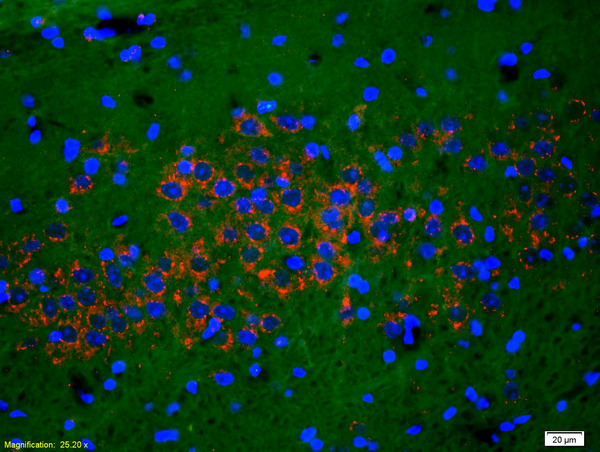 Formalin-fixed and paraffin-embedded rat brain labeled with Anti-Phospho-NMDAR1(Ser890) Polyclonal Antibody, Unconjugated(bs-3301R) 1:200, overnight at 4\u00b0C, The secondary antibody was Goat Anti-Rabbit IgG, Cy3 conjugated(bs-0295G-Cy3)used at 1:200 dilution for 40 minutes at 37\u00b0C.