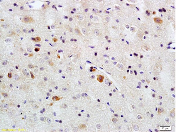 Formalin-fixed and paraffin embedded rat brain tissue labeled with Rabbit Anti-PACAP-38 Polyclonal Antibody (bs-0200R) , Unconjugated at 1:200 followed by conjugation to the secondary antibody and DAB staining.