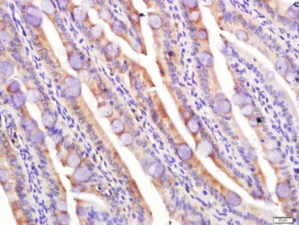 Paraformaldehyde-fixed, paraffin embedded rat small intestine tissue; Antigen retrieval by boiling in sodium citrate buffer(pH6) for 15min; Block endogenous peroxidase by 3% hydrogen peroxide for 30 minutes; Blocking buffer (normal goat serum) at 37°C for 20min; Antibody incubation with Rabbit Anti-LPL Polyclonal Antibody, Unconjugated (bs-1973R) at 1:400 overnight at 4°C, followed by a conjugated secondary and DAB staining\t\t\t\t