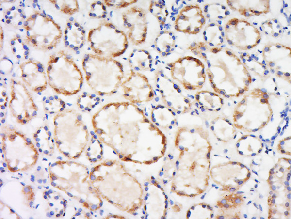 Paraformaldehyde-fixed, paraffin embedded mouse kidney tissue; Antigen retrieval by boiling in sodium citrate buffer (pH6.0) for 15min; Block endogenous peroxidase by 3% hydrogen peroxide for 20 minutes; Blocking buffer (normal goat serum) at 37°C for 30min; Antibody incubation with Dematin Polyclonal Antibody, Unconjugated (bs-20187R) at 1:400 overnight at 4°C, followed by a conjugated secondary for 20 minutes and DAB staining.
