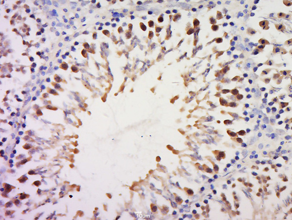 Paraformaldehyde-fixed, paraffin embedded rat testis tissue; Antigen retrieval by boiling in sodium citrate buffer (pH6.0) for 15min; Block endogenous peroxidase by 3% hydrogen peroxide for 20 minutes; Blocking buffer (normal goat serum) at 37°C for 30min; Antibody incubation with \tRPS20 Polyclonal Antibody, Unconjugated (bs-18322R) at 1:400 overnight at 4°C, followed by a conjugated secondary for 20 minutes and DAB staining.