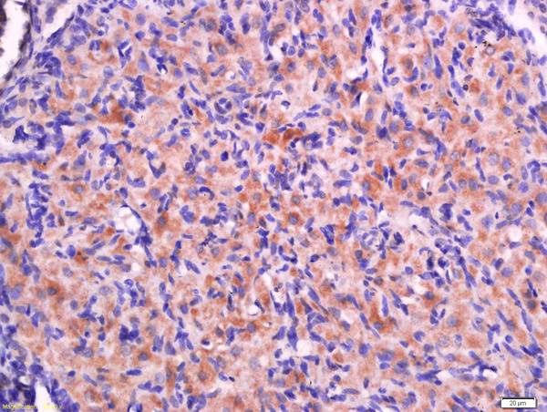 Paraformaldehyde-fixed, paraffin embedded rat ovary tissue; Antigen retrieval by boiling in sodium citrate buffer (pH6.0) for 15min; Block endogenous peroxidase by 3% hydrogen peroxide for 20 minutes; Blocking buffer (normal goat serum) at 37°C for 30min; Antibody incubation with RPS20 Polyclonal Antibody, Unconjugated (bs-18322R) at 1:400 overnight at 4°C, followed by a conjugated secondary for 20 minutes and DAB staining. Paraformaldehyde-fixed, paraffin embedded rat ovary tissue; Antigen retrieval by boiling in sodium citrate buffer (pH6.0) for 15min; Block endogenous peroxidase by 3% hydrogen peroxide for 20 minutes; Blocking buffer (normal goat serum) at 37°C for 30min; Antibody incubation with RPS20 Polyclonal Antibody, Unconjugated (bs-18322R) at 1:400 overnight at 4°C, followed by a conjugated secondary for 20 minutes and DAB staining.