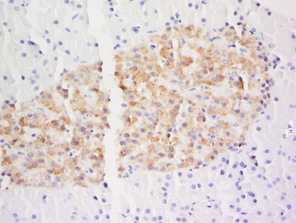 Paraformaldehyde-fixed, paraffin embedded rat pancreas tissue tissue; Antigen retrieval by boiling in sodium citrate buffer (pH6.0) for 15min; Block endogenous peroxidase by 3% hydrogen peroxide for 20 minutes; Blocking buffer (normal goat serum) at 37°C for 30min; Antibody incubation with DSCR3 Polyclonal Antibody, Unconjugated (bs-14430R) at 1:400 overnight at 4°C, followed by a conjugated secondary for 20 minutes and DAB staining.