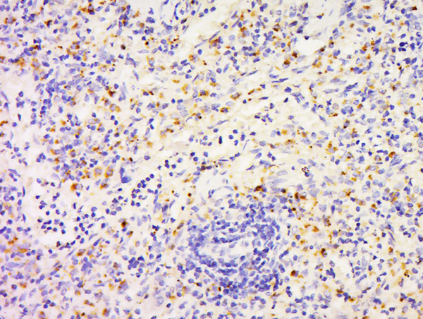 Paraformaldehyde-fixed, paraffin embedded Rat Spleen; Antigen retrieval by boiling in sodium citrate buffer (pH6.0) for 15min; Block endogenous peroxidase by 3% hydrogen peroxide for 30 minutes; Blocking buffer (normal goat serum) at 37°C for 20min; Antibody incubation with FAM3D Polyclonal Antibody, Unconjugated (bs-14992R) at 1:500 overnight at 4°C, followed by a conjugated secondary and DAB staining.