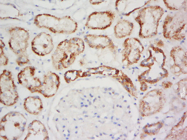 Paraformaldehyde-fixed, paraffin embedded human kidney tissue; Antigen retrieval by boiling in sodium citrate buffer (pH6.0) for 15min; Block endogenous peroxidase by 3% hydrogen peroxide for 20 minutes; Blocking buffer (normal goat serum) at 37°C for 30min; Antibody incubation with GPR137A Polyclonal Antibody, Unconjugated (bs-16270R) at 1:400 overnight at 4°C, followed by a conjugated secondary for 20 minutes and DAB staining.