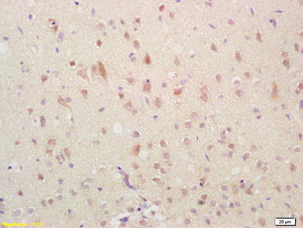 Formalin-fixed and paraffin embedded rat brain labeled with Anti-GADD45 Polyclonal Antibody, Unconjugated (bs-1360R)  followed by conjugation to the secondary antibody and DAB staining