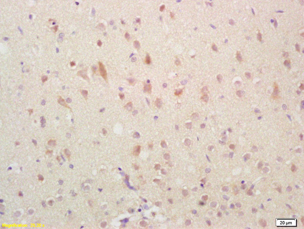Formalin-fixed and paraffin embedded rat brain labeled with Anti-GADD45 Polyclonal Antibody, Unconjugated (bs-1360R) followed by conjugation to the secondary antibody and DAB staining