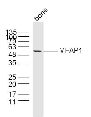 Mouse bone lysates probed with MFAP1 Polyclonal Antibody, unconjugated (bs-7810R) at 1:300 overnight at 4°C followed by a conjugated secondary antibody at 1:10000 for 60 minutes at 37°C.