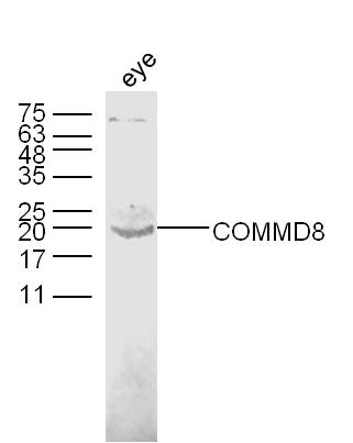 Mouse eye lysates probed with COMMD8 Polyclonal Antibody, unconjugated (bs-8182R) at 1:300 overnight at 4°C followed by a conjugated secondary antibody at 1:10000 for 60 minutes at 37°C.