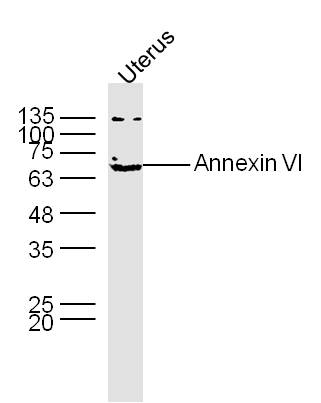Mouse uterus lysates probed with Annexin VI Polyclonal Antibody, unconjugated (bs-8997R) at 1:300 overnight at 4°C followed by a conjugated secondary antibody at 1:10000 for 60 minutes at 37°C.