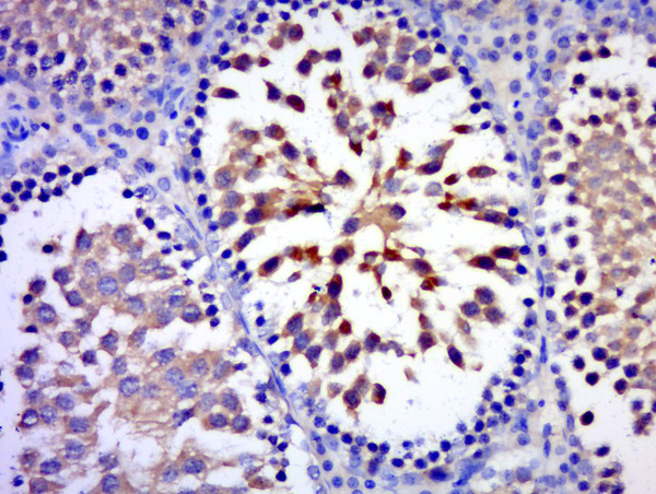 Paraformaldehyde-fixed, paraffin embedded rat testis tissue; Antigen retrieval by boiling in sodium citrate buffer(pH6) for 15min; Block endogenous peroxidase by 3% hydrogen peroxide for 30 minutes; Blocking buffer (normal goat serum) at 37°C for 20min; Antibody incubation with Rabbit Anti-C17orf75 Polyclonal Antibody, Unconjugated (bs-9646R) at 1:400 overnight at 4°C, followed by a conjugated secondary and DAB staining