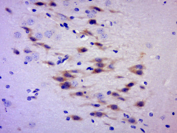 Paraformaldehyde-fixed, paraffin embedded rat brain tissue; Antigen retrieval by boiling in sodium citrate buffer(pH6) for 15min; Block endogenous peroxidase by 3% hydrogen peroxide for 30 minutes; Blocking buffer (normal goat serum) at 37°C for 20min; Antibody incubation with Rabbit Anti-C2orf55 Polyclonal Antibody, Unconjugated (bs-9817R) at 1:500 overnight at 4°C, followed by a conjugated secondary and DAB staining
