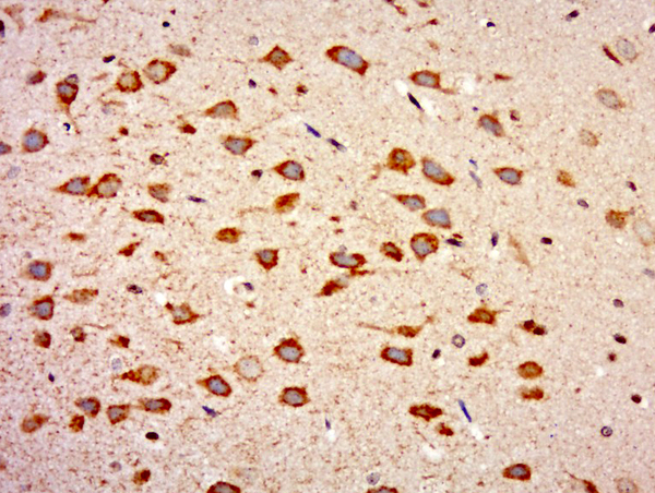 Paraformaldehyde-fixed, paraffin embedded rat brain tissue; Antigen retrieval by boiling in sodium citrate buffer(pH6) for 15min; Block endogenous peroxidase by 3% hydrogen peroxide for 30 minutes; Blocking buffer (normal goat serum) at 37°C for 20min; Antibody incubation with Rabbit Anti-WIPF2 Polyclonal Antibody, Unconjugated (bs-9869R) at 1:500 overnight at 4°C, followed by a conjugated secondary and DAB staining