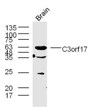Lane 1: mouse brain lysates probed with C3orf17 Polyclonal Antibody, Unconjugated (bs-9824R) at 1:300 overnight at 4˚C. Followed by a conjugated secondary antibody at 1:10000 for 90 min at 37˚C.