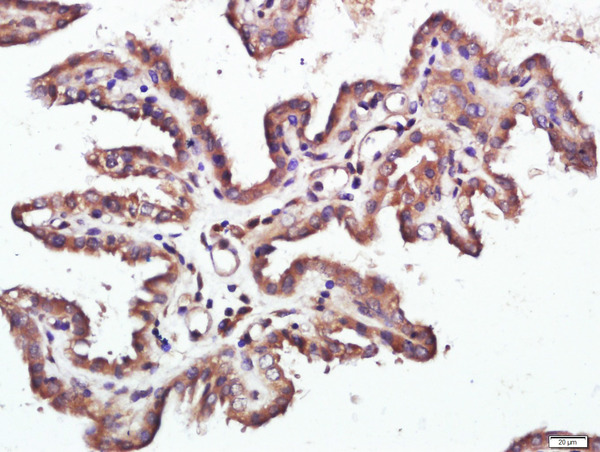 Paraformaldehyde-fixed, paraffin embedded mouse placenta; Antigen retrieval by boiling in sodium citrate buffer (pH6.0) for 15min; Block endogenous peroxidase by 3% hydrogen peroxide for 20 minutes; Blocking buffer (normal goat serum) at 37°C for 30min; Antibody incubation with Raptor Polyclonal Antibody, Unconjugated (bs-3559R) at 1:400 overnight at 4°C, followed by a conjugated secondary for 20 minutes and DAB staining.