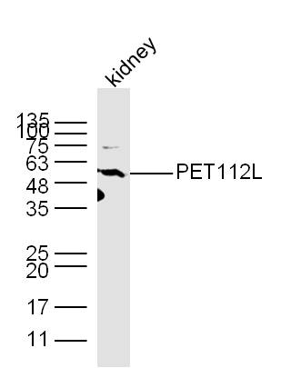 Mouse kidney lysates probed with PET112L Polyclonal Antibody, unconjugated (bs-11667R) at 1:300 overnight at 4°C followed by a conjugated secondary antibody at 1:10000 for 60 minutes at 37°C.