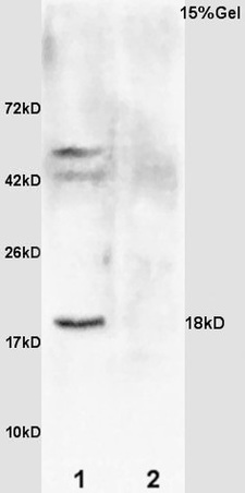 L1 rat brain lysates L2 rat kidney lysates probed with Rabbit Anti-GADD45 Polyclonal Antibody, Unconjugated (bs-1360R) at 1:200 overnight at 4˚C. Followed by conjugation to secondary antibody (bs-0295G-HRP) at 1:3000 for 90 min at 37˚C. Predicted band 18kD. Observed band size: 18kD.