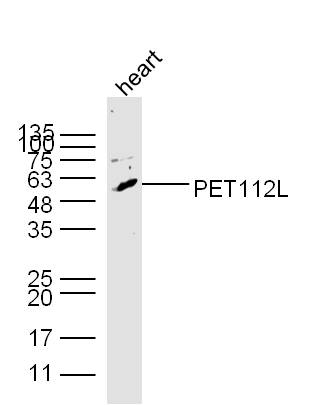 Mouse heart lysates probed with PET112L Polyclonal Antibody, unconjugated (bs-11667R) at 1:300 overnight at 4°C followed by a conjugated secondary antibody at 1:10000 for 60 minutes at 37°C.