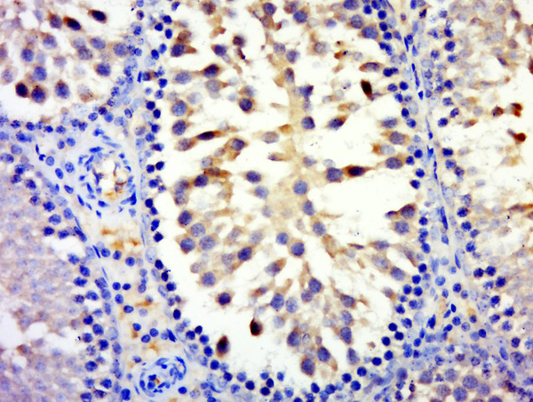 Paraformaldehyde-fixed, paraffin embedded rat testis tissue; Antigen retrieval by boiling in sodium citrate buffer(pH6) for 15min; Block endogenous peroxidase by 3% hydrogen peroxide for 30 minutes; Blocking buffer (normal goat serum) at 37°C for 20min; Antibody incubation with Rabbit Anti-MYCBPAP Polyclonal Antibody, Unconjugated (bs-13614R) at 1:500 overnight at 4°C, followed by a conjugated secondary and DAB staining Paraformaldehyde-fixed, paraffin embedded rat testis tissue; Antigen retrieval by boiling in sodium citrate buffer(pH6) for 15min; Block endogenous peroxidase by 3% hydrogen peroxide for 30 minutes; Blocking buffer (normal goat serum) at 37°C for 20min; Antibody incubation with Rabbit Anti-MYCBPAP Polyclonal Antibody, Unconjugated (bs-13614R) at 1:500 overnight at 4°C, followed by a conjugated secondary and DAB staining