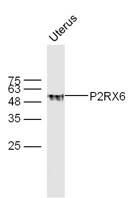 Mouse uterus lysates probed with P2RX6 Polyclonal Antibody, unconjugated (bs-12110R) at 1:300 overnight at 4°C followed by a conjugated secondary antibody at 1:10000 for 60 minutes at 37°C.