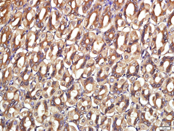 Paraformaldehyde-fixed, paraffin embedded mouse stomach; Antigen retrieval by boiling in sodium citrate buffer (pH6) for 15min; Block endogenous peroxidase by 3% hydrogen peroxide for 30 minutes; Blocking buffer (normal goat serum) at 37°C for 20min; Antibody incubation with CDCP1 Polyclonal Antibody (bs-5880R) at 1:400 overnight at 4°C, followed by a conjugated secondary and DAB staining.