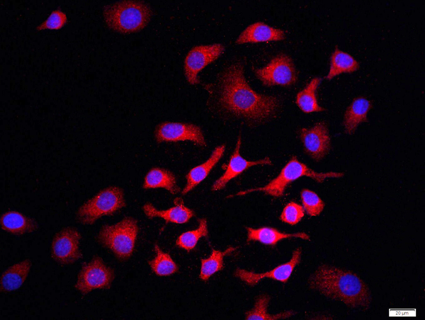 HepG2 cells were stained with PI3 kinase p85 alpha subunit Polyclonal Antibody, Unconjugated(bs-0128R) at 1:500 in PBS and incubated for two hours at 37°C followed by Goat Anti-Rabbit IgG (H+L) Cy3 conjugated secondary antibody. DAPI staining of the nucleus was done and then detected.