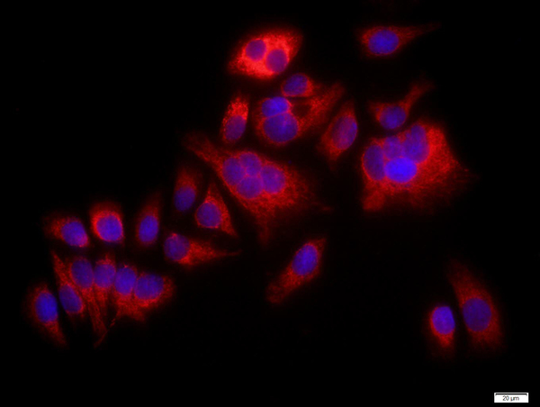 MCF-7 cells were stained with p38 MAPK Polyclonal Antibody, Unconjugated(bs-0637R) at 1:500 in PBS and incubated for two hours at 37°C followed by Goat Anti-Rabbit IgG (H+L) Cy3 conjugated secondary antibody. DAPI staining of the nucleus was done and then detected.