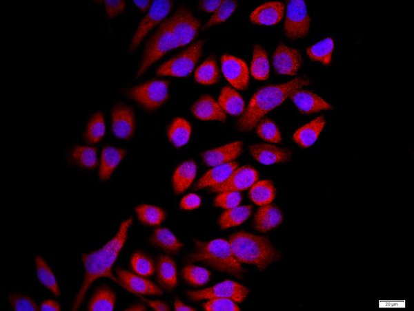 MCF-7 cells were stained with Connexin 43 Polyclonal Antibody, Unconjugated(bs-0651R) at 1:500 in PBS and incubated for two hours at 37°C followed by Goat Anti-Rabbit IgG (H+L) Cy3 conjugated secondary antibody. DAPI staining of the nucleus was done and then detected.