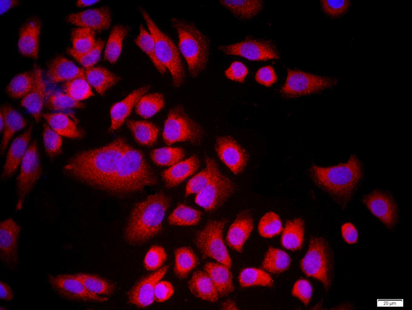 MCF-7 cells were stained with CDKN1B Polyclonal Antibody, Unconjugated(bs-0742R) at 1:500 in PBS and incubated for two hours at 37°C followed by Goat Anti-Rabbit IgG (H+L) Cy3 conjugated secondary antibody. DAPI staining of the nucleus was done and then detected.