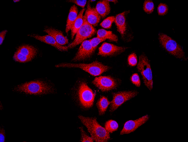 MCF-7 cells were stained with WDR26 Polyclonal Antibody, Unconjugated(bs-0932R) at 1:500 in PBS and incubated for two hours at 37\u00b0C followed by Goat Anti-Rabbit IgG (H+L) Cy3 conjugated secondary antibody. DAPI staining of the nucleus was done and then detected.