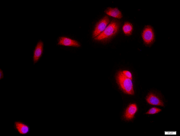 MCF-7 cells were stained with SKP2 Polyclonal Antibody, Unconjugated(bs-1096R) at 1:500 in PBS and incubated for two hours at 37°C followed by Goat Anti-Rabbit IgG (H+L) Cy3 conjugated secondary antibody. DAPI staining of the nucleus was done and then detected.